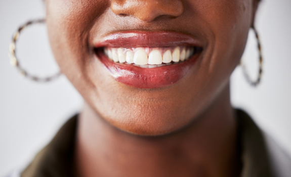 Closeup of woman’s smile after advanced dental hygiene